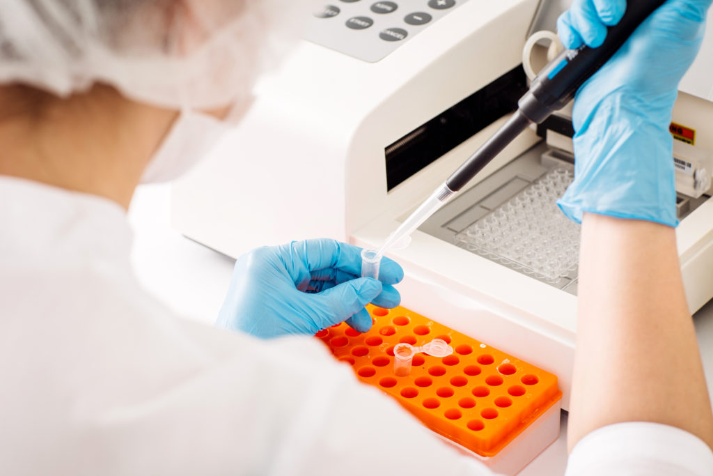 Scientist in lab sampling - Bovine TB